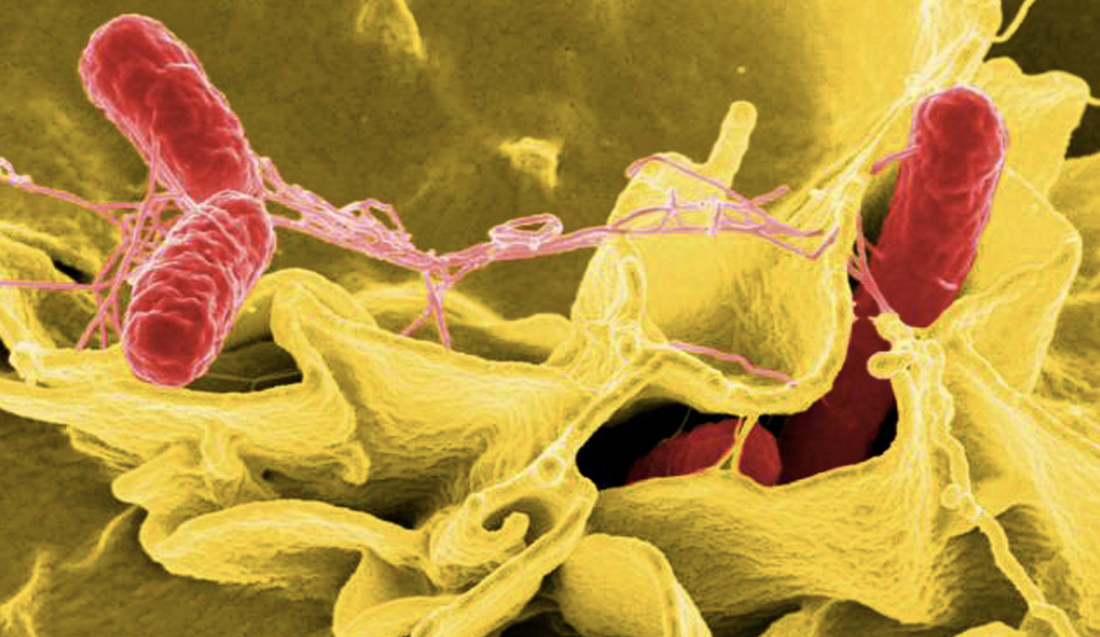 Salmonella bacteria