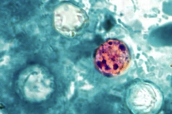 cyclospora from CDC